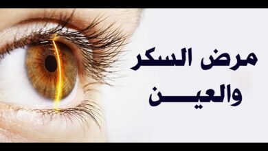 هل العين تكشف السكري؟.. أعراض مبكرة يجب الانتباه لها