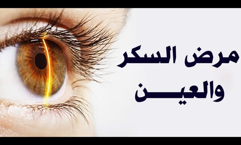 هل العين تكشف السكري؟.. أعراض مبكرة يجب الانتباه لها