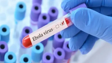 مصر تعلن حالة التأهب القصوى لمواجهة فيروس إيبولا وتؤكد خلو البلاد من الإصابات